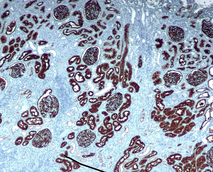 immunohistochemistry