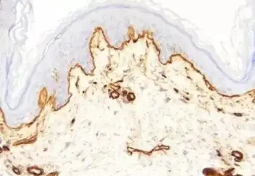 [A1112-1] Nitric Oxide Synthase (599-613) Blocking Peptide, Bovine Endothelial Cell - 1mg